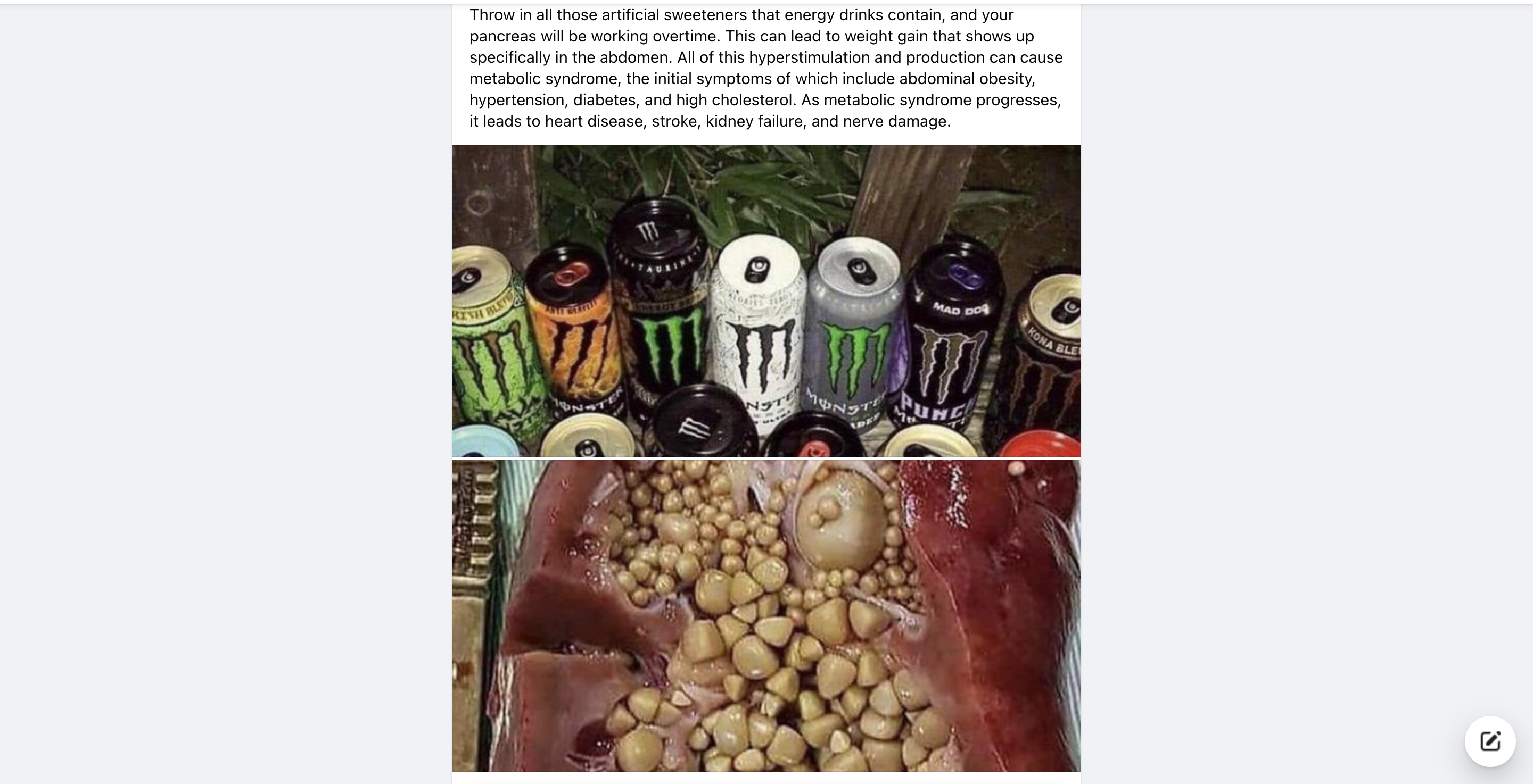 fact-check-photo-does-not-prove-link-between-energy-drinks-and-kidney